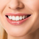 Cosmetic Dentist for Veneers Central HK